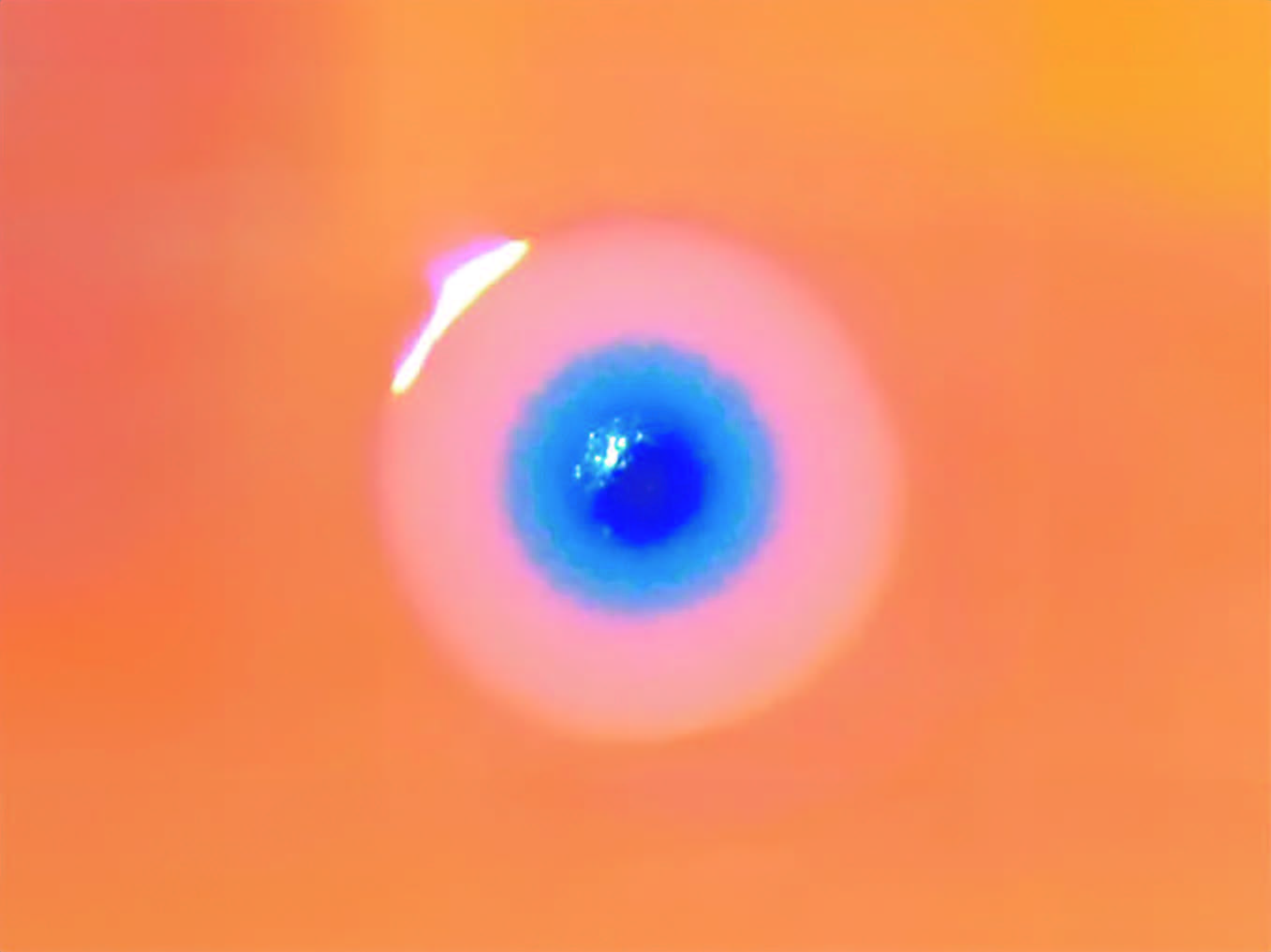 A cellule, like a pink ovum with a blue yolk, set against a field of orange, the image representing a sample of the artificial bacterium called Mycoplasma laboratorium, invented by Craig Venter.